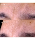 RENERGIE Sérum visage