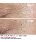 TOTAL EYE LIFT RECHARGEABLE Contour des yeux anti-âge 