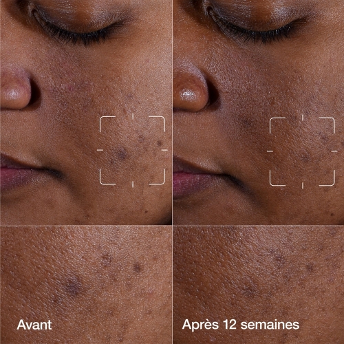 EVEN BETTER Even Better Clinical™ - Sérum Illuminateur Anti-taches