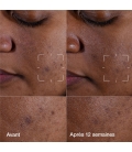 EVEN BETTER Even Better Clinical™ - Sérum Illuminateur Anti-taches