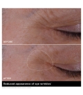 DOUBLE SERUM EYE Concentré yeux anti-âge complet
