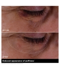 DOUBLE SERUM EYE Concentré yeux anti-âge complet