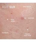 SÉRUM CORRECTEUR PEAUX À IMPERFECTIONS Sérum correcteur anti-imperfections visage
