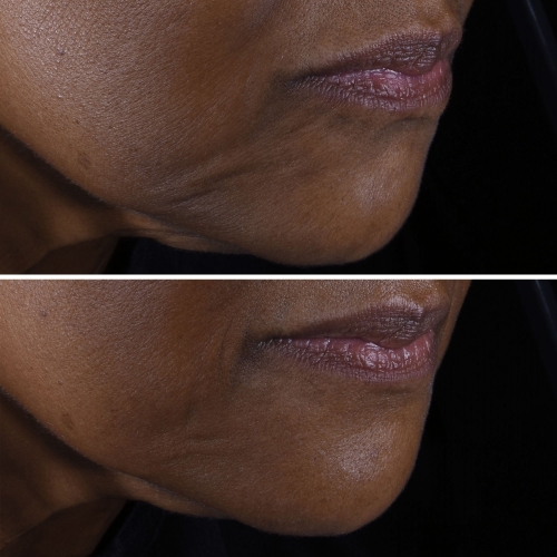SMART CLINICAL Smart Clinical Repair™ Crème Liftante Visage + Cou