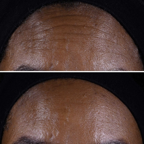 SMART CLINICAL Smart Clinical Repair™ Crème Liftante Visage + Cou