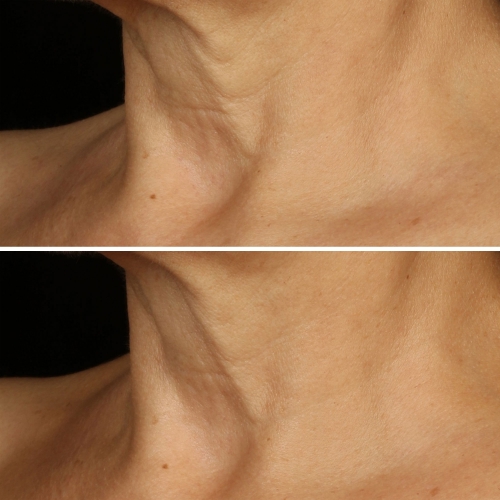 SMART CLINICAL Smart Clinical Repair™ Crème Liftante Visage + Cou